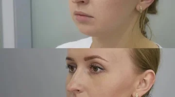 Центр косметологии Flash Skin Clinic изображение 14
